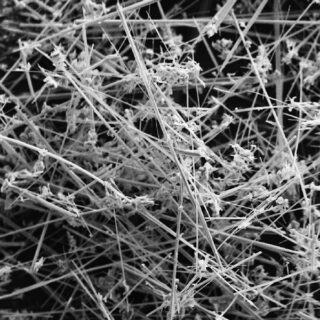 Nahaufnahme, Schwarzweiß-Mikroskopbild, das ein dichtes Netzwerk aus dünnen, nadelartigen Fasern und Strukturen zeigt, die vor einem dunklen Hintergrund ineinander verschlungen sind.