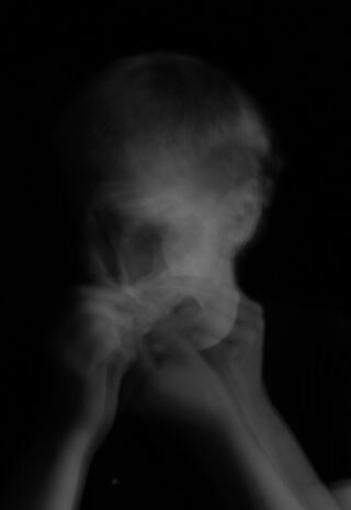 Ein verschwommenes Schwarzweißbild einer Person mit undeutlichen Gesichtszügen und Händen, das vor einem dunklen Hintergrund eine Bewegung suggeriert.