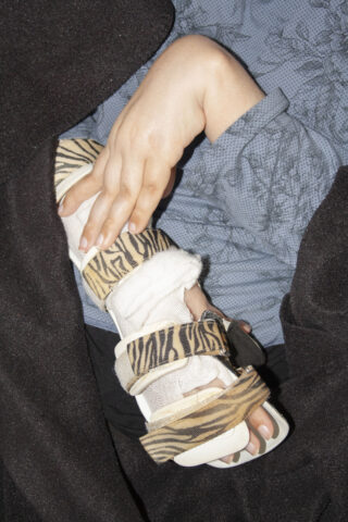 Die Hand einer Person ruht auf ihrem Bein, das in einer medizinischen Fußorthese mit Zebramuster befestigt und teilweise mit einer schwarzen Decke bedeckt ist.