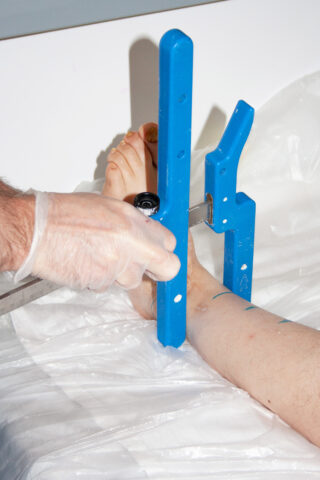 Der Fuß und der Unterschenkel einer Person werden mit einem blauen orthopädischen Messgerät gemessen; eine behandschuhte Hand hält das Instrument.