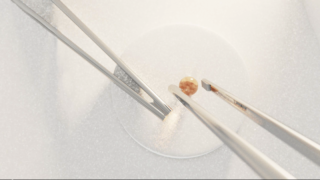 Zwei Metallpinzetten halten einen kleinen, runden, beigen Gegenstand über einer weißen kreisförmigen Oberfläche.