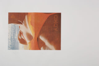 Eine Nahaufnahme einer Person in einem orangefarbenen Bikini an einem Strand. Auf dem Bild sind der Text „ADHS“ und die Zahl „5“ vor einem weißen Hintergrund aufgedruckt.