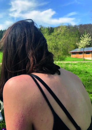 Eine Person mit schulterlangem braunem Haar sitzt von hinten im Freien auf einer Wiese und trägt ein schwarzes Trägertop. Im Hintergrund sind Bäume, blauer Himmel und ein Gebäude zu sehen.