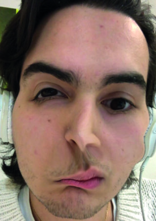 Eine Person mit weißen Kopfhörern und verzerrtem Gesicht (möglicherweise durch einen digitalen Filter oder Linseneffekt) blickt direkt in die Kamera.