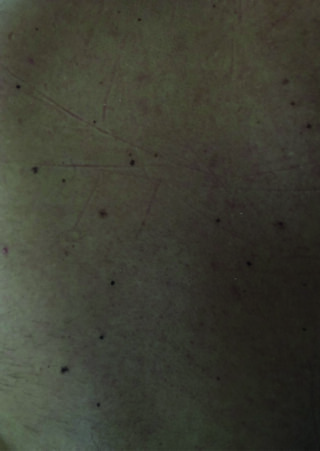 Nahaufnahme einer grünlichen Oberfläche mit mehreren kleinen dunklen Flecken und schwachen Kratzern oder Linien.