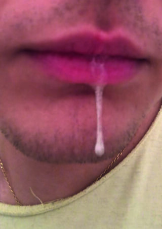 Nahaufnahme des Mundes einer Person, aus der ein Speichelfaden von der Unterlippe bis zum Kinn hängt.