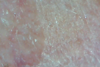 Nahaufnahme der menschlichen Haut mit feinen Linien, Poren und verschiedenen Texturen in Rosa- und Beigetönen.