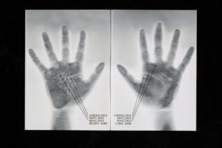 Zwei nebeneinander liegende Schwarzweiß-Handabdruckbilder, jeweils mit Linien beschriftet, die auf Handflächenlinien zeigen und mit „Lebenslinie, Kopflinie, Herzlinie“ für die rechte und linke Hand beschriftet sind.