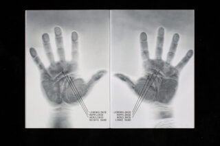 Schwarzweißbild der linken und rechten Handabdrücke mit den auf Deutsch beschrifteten Linien „Lebenslinie“, „Kopflinie“ und „Herzlinie“, die Handleselinien darstellen.