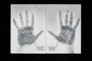 Röntgenbild im Stil einer linken und rechten Handfläche mit beschrifteten Linien: Lebenslinie, Kopflinie und Herzlinie, jeweils auf Deutsch und Englisch angegeben.