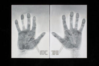 Schwarzweißbild im Röntgenstil von zwei offenen Händen, das mit Linien und deutschem Text beschriftet ist, der die Handflächenlinien der linken und rechten Hand identifiziert.