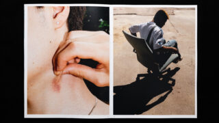 Links: Nahaufnahme einer Person, die sich in die Haut am Hals kneift und einen blauen Fleck freilegt. Rechts: Person, die im Freien auf einem Bürostuhl sitzt und einen Schatten auf den Boden wirft.