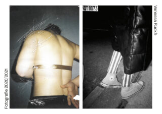 Ein geteiltes Bild: links ist der nackte Rücken einer Person mit Kratzern zu sehen, die teilweise mit Klebeband umwickelt sind; rechts sind Beine in gestreiften Hosen und Converse-Schuhen unter einem langen, dunklen Mantel zu sehen.