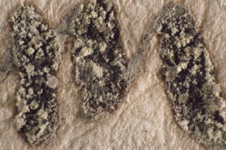 Nahaufnahme des Schimmelwachstums auf einer strukturierten Oberfläche. Sie zeigt Ansammlungen von Sporen und Hyphen in drei deutlich erkennbaren Flecken.