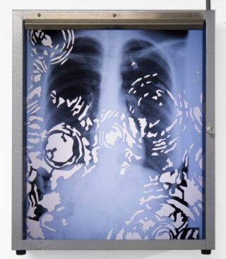 Auf einer beleuchteten Röntgenaufnahme des Brustkorbs sind die Lungen zu sehen, auf denen kunstvolle, kreisförmige Schwarzweißmuster über das Bild gelegt sind.