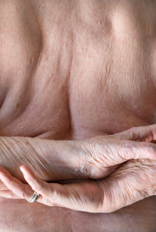 Nahaufnahme des nackten Rückens und Arms einer älteren Person, die faltige Haut und einen silbernen Ring an einem Finger zeigt. Der Arm ist sanft über dem Körper gekreuzt.