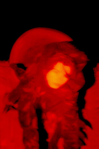 Abstraktes Bild des Gesichts und des Oberkörpers einer Person in roten und gelben Tönen, unscharf und undeutlich vor einem schwarzen Hintergrund.